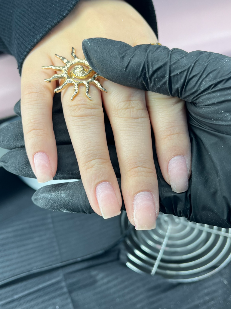 nail sets after a removal